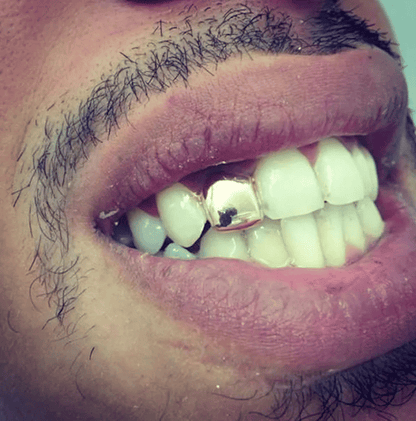 Trendy Hip Hop Rapper Gold Silver Grillz Caps Top Bottom Teeth Jewelry